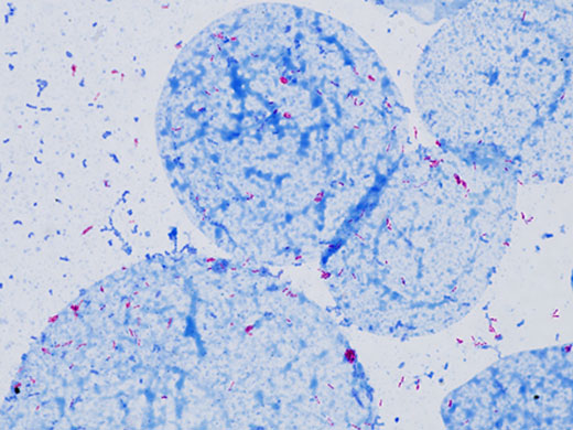 奧林巴斯顯微鏡