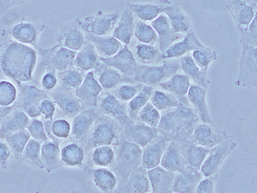奧林巴斯顯微鏡